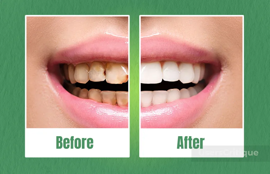 ProDentim is a Health Of Your Teeth And Gums supplement